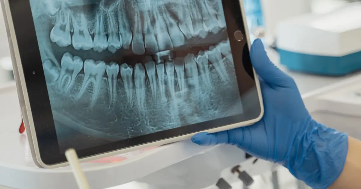 Dicas para Criar Rifas com Produtos de Tecnologia para Saúde